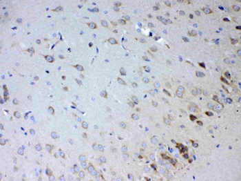 Anti-IL15RA Antibody