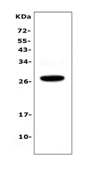 Anti-IL15RA Antibody