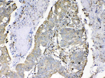 Anti-Cyclophilin B/PPIB Antibody