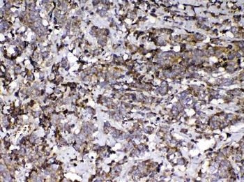 Anti-Vitamin D Binding protein/GC Antibody