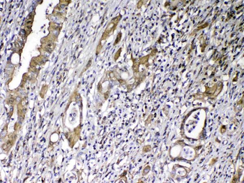 Anti-Vitamin D Binding protein/GC Antibody