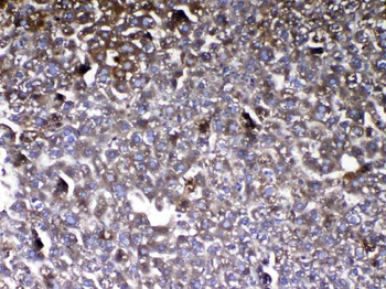 Anti-Vitamin D Binding protein/GC Antibody