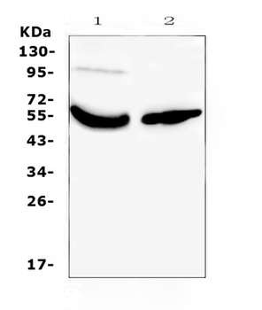 Anti-Vitamin D Binding protein/GC Antibody