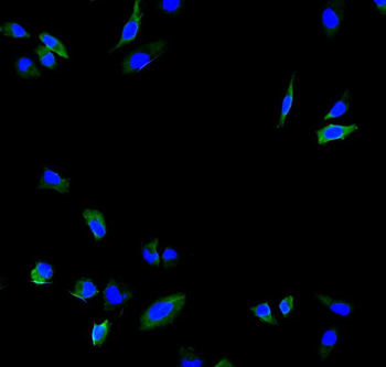 Anti-Calpain 2/CAPN2 Antibody