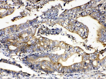 Anti-Calpain 2/CAPN2 Antibody