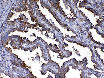 Calpain 2/CAPN2 Antibody