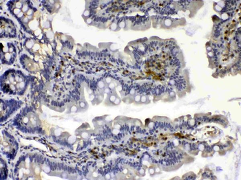 Anti-Calpain 2/CAPN2 Antibody