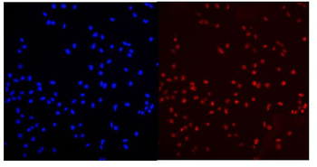 Anti-MED15 Antibody