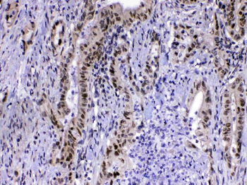 Anti-MED15 Antibody