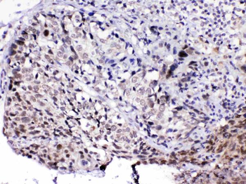 Anti-MED15 Antibody