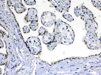 Anti-MED15 Antibody