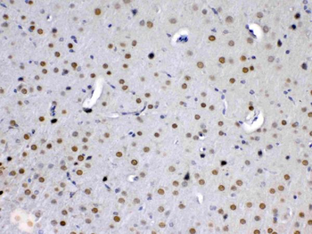 Anti-MED15 Antibody