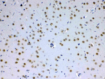 Anti-MED15 Antibody