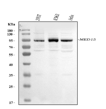 Anti-MED15 Antibody
