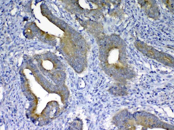 Anti-MMP10 Antibody