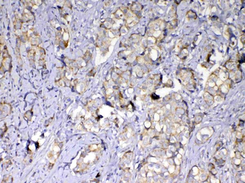 Anti-MMP10 Antibody