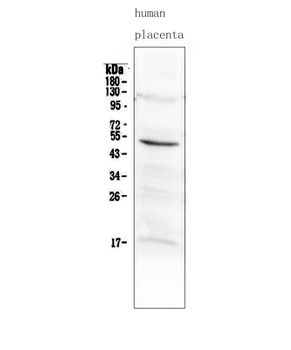 Anti-MMP10 Antibody