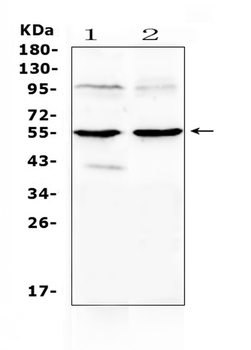 Anti-MMP10 Antibody