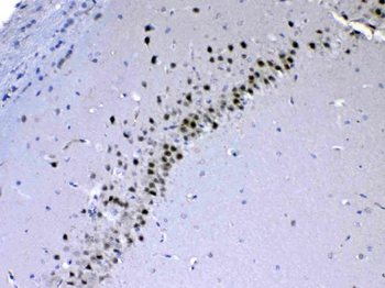 CHD2 Antibody