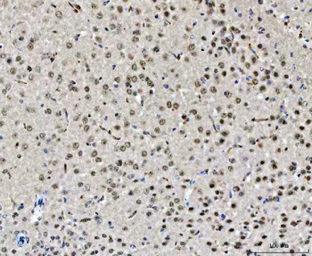 CHD2 Antibody