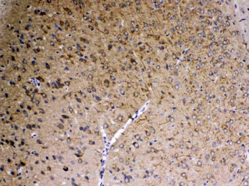 Anti-SAP102/DLG3 Antibody