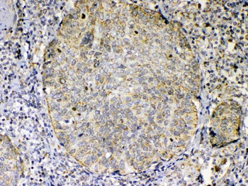 Anti-TNFSF18 Antibody