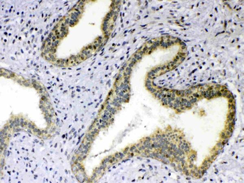 Anti-TNFSF18 Antibody