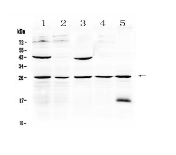 Anti-Noggin Antibody