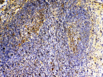 Anti-VEGFB Antibody