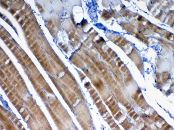 Anti-VEGFB Antibody