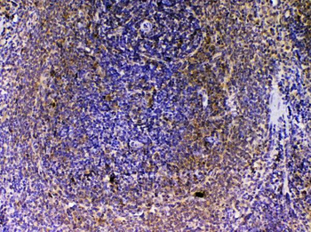 Anti-VEGFB Antibody