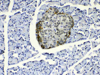 Anti-COPE Antibody