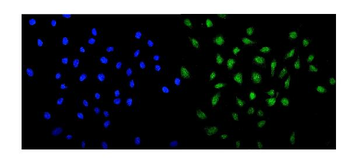 Anti-MED13 Antibody