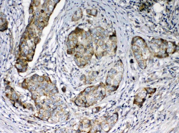 Anti-FZD3 Antibody