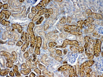 Anti-FZD3 Antibody