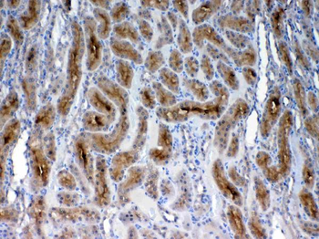 Anti-FZD3 Antibody