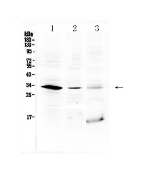 HOXB1 Rabbit Polyclonal Antibody