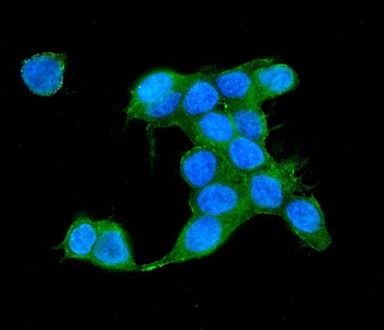 Anti-IQGAP2 Antibody