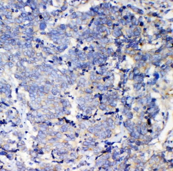 Anti-IQGAP2 Antibody