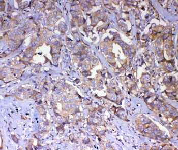 Anti-IQGAP2 Antibody