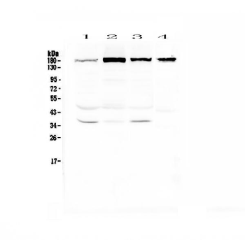 Anti-IQGAP2 Antibody
