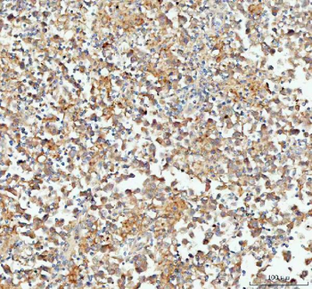 Anti-CP110/CCP110 Antibody
