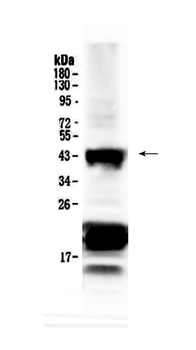 CHX10/VSX2 Antibody
