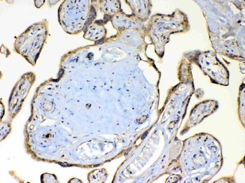 Anti-TSPAN12 Antibody