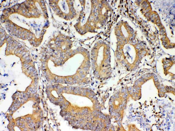 Anti-TSPAN12 Antibody