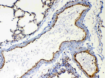 Anti-TSPAN12 Antibody