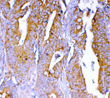 Anti-DYNLT1 Antibody