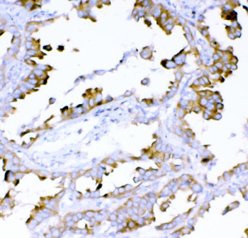 Anti-DYNLT1 Antibody