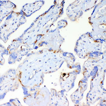 Anti-DYNLT1 Antibody