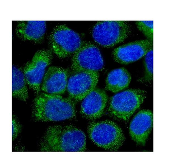 Anti-NOV/CCN3 Antibody